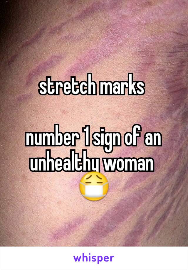 stretch marks 

number 1 sign of an unhealthy woman 
😷