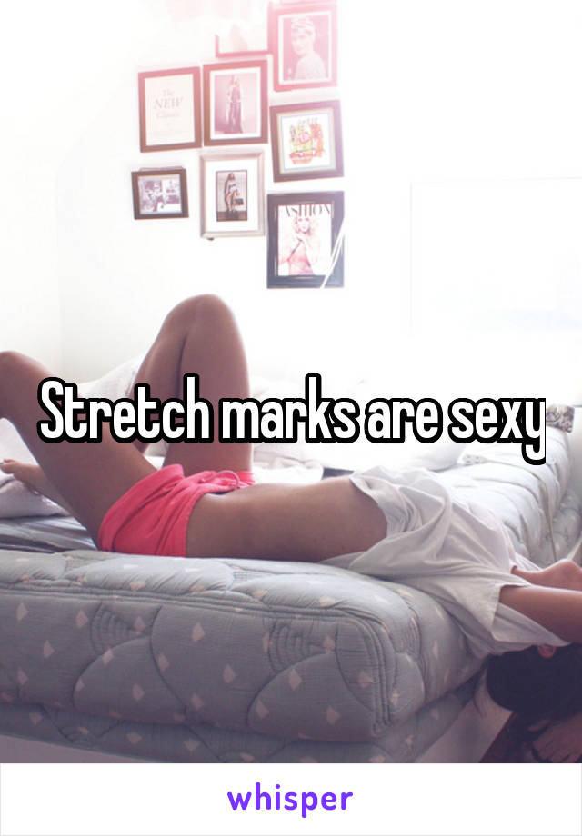 Stretch marks are sexy
