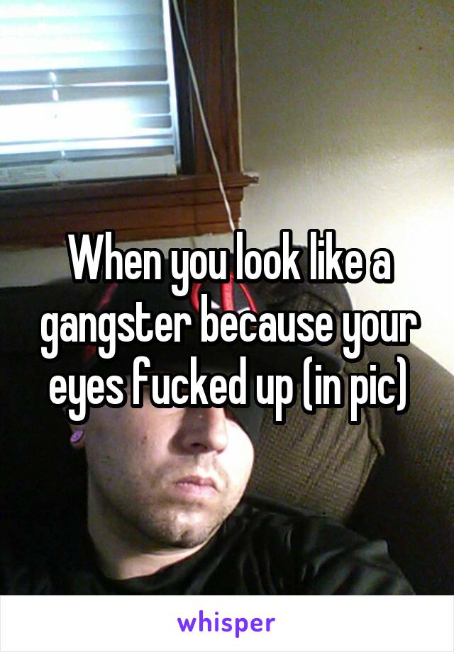 When you look like a gangster because your eyes fucked up (in pic)