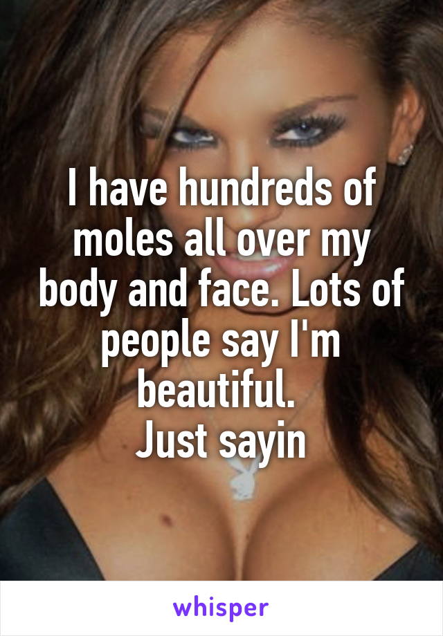 I have hundreds of moles all over my body and face. Lots of people say I'm beautiful. 
Just sayin