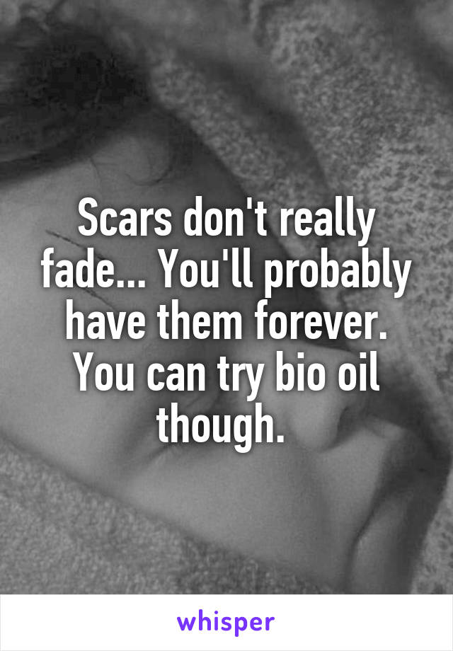 Scars don't really fade... You'll probably have them forever. You can try bio oil though. 