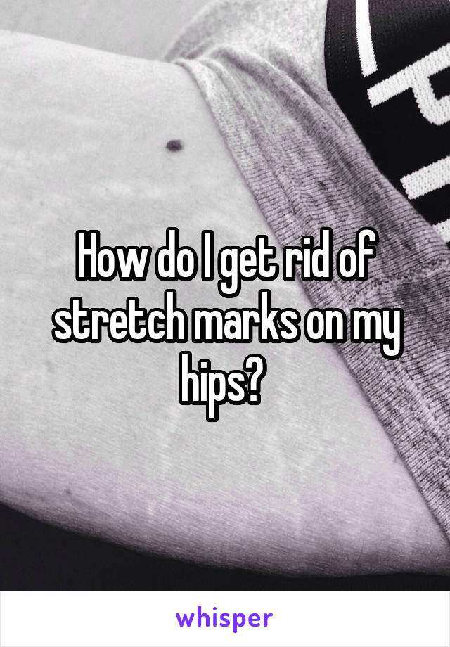 How do I get rid of stretch marks on my hips? 