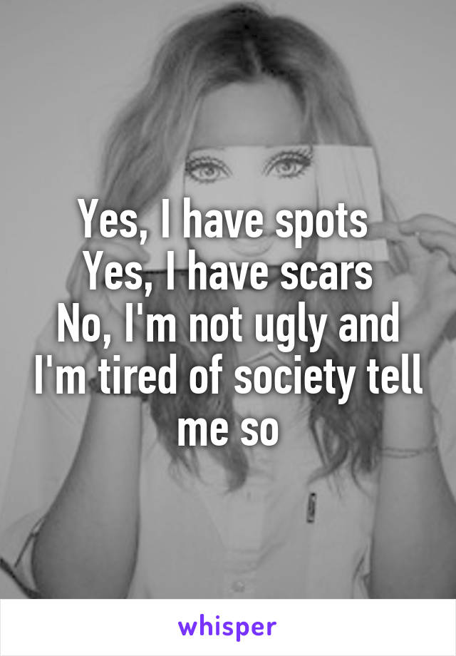 Yes, I have spots 
Yes, I have scars
No, I'm not ugly and I'm tired of society tell me so