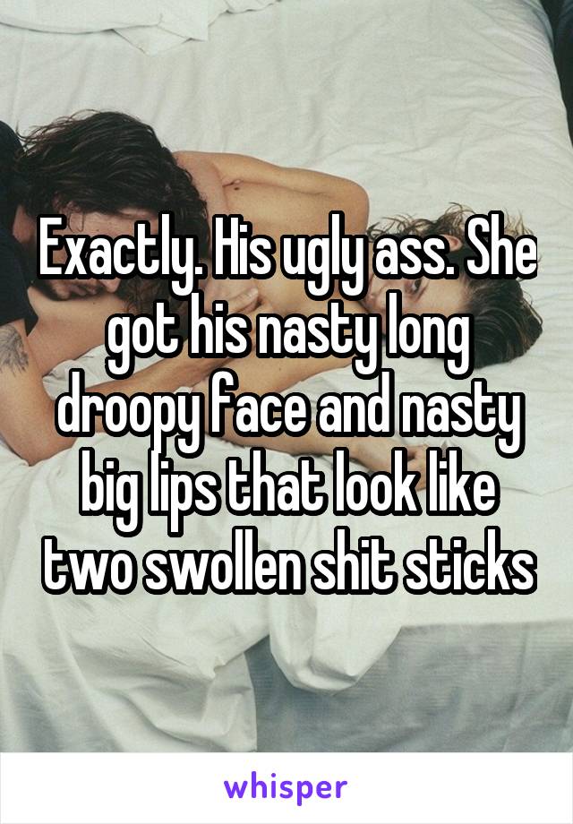 Exactly. His ugly ass. She got his nasty long droopy face and nasty big lips that look like two swollen shit sticks