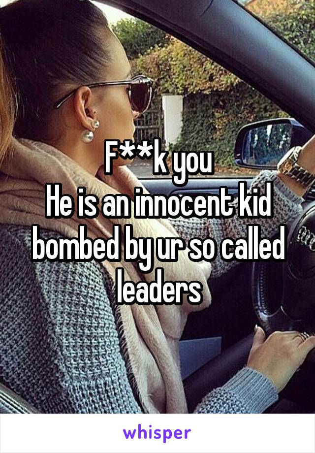 F**k you
He is an innocent kid bombed by ur so called leaders