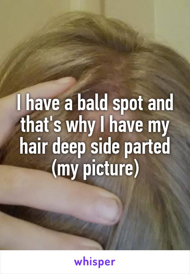 I have a bald spot and that's why I have my hair deep side parted (my picture)