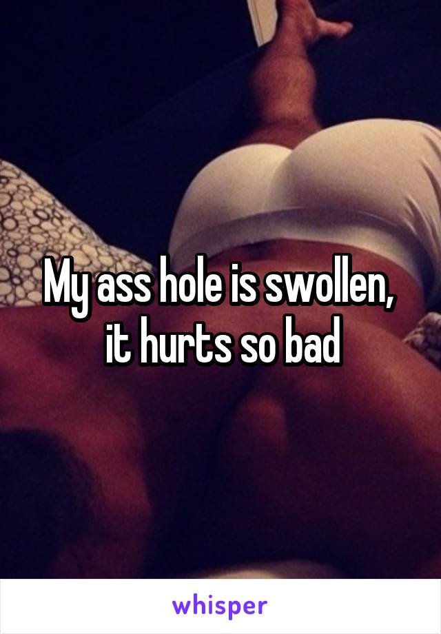 My ass hole is swollen,  it hurts so bad