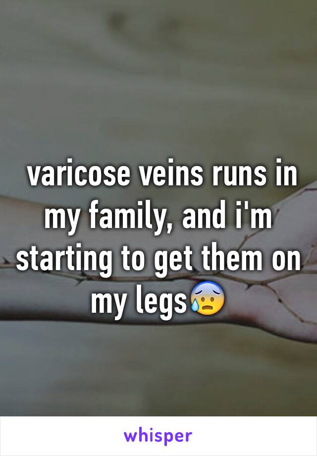  varicose veins runs in my family, and i'm starting to get them on my legs😰