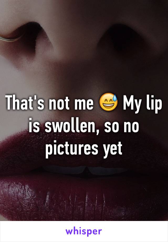That's not me 😅 My lip is swollen, so no pictures yet