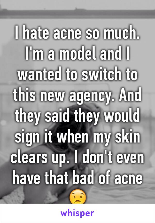 I hate acne so much. I'm a model and I wanted to switch to this new agency. And they said they would sign it when my skin clears up. I don't even have that bad of acne 😟