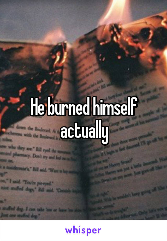 He burned himself actually