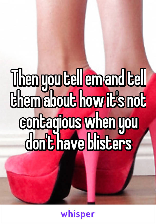 Then you tell em and tell them about how it's not contagious when you don't have blisters