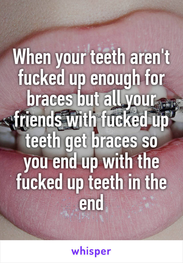When your teeth aren't fucked up enough for braces but all your friends with fucked up teeth get braces so you end up with the fucked up teeth in the end