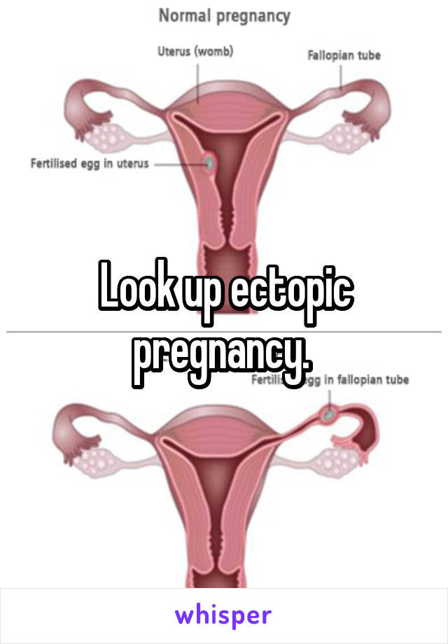 Look up ectopic pregnancy. 