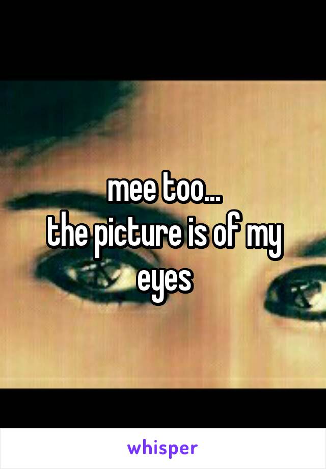 mee too...
the picture is of my eyes