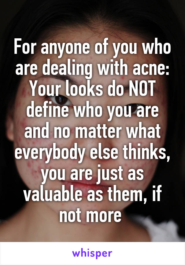 For anyone of you who are dealing with acne:
Your looks do NOT define who you are and no matter what everybody else thinks, you are just as valuable as them, if not more 