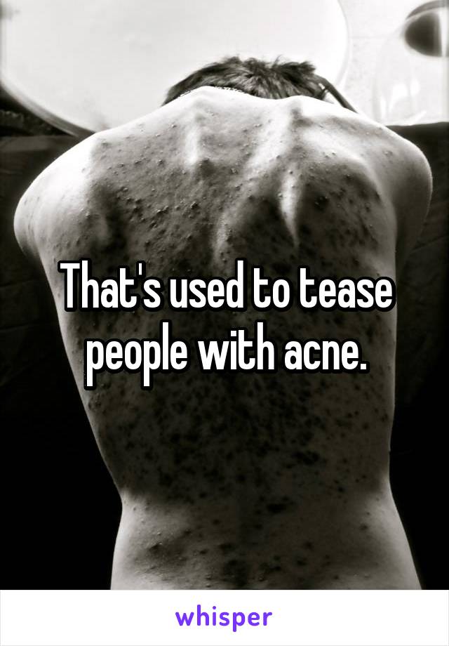 That's used to tease people with acne.