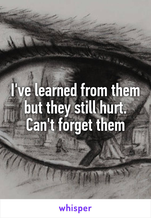 I've learned from them but they still hurt. Can't forget them