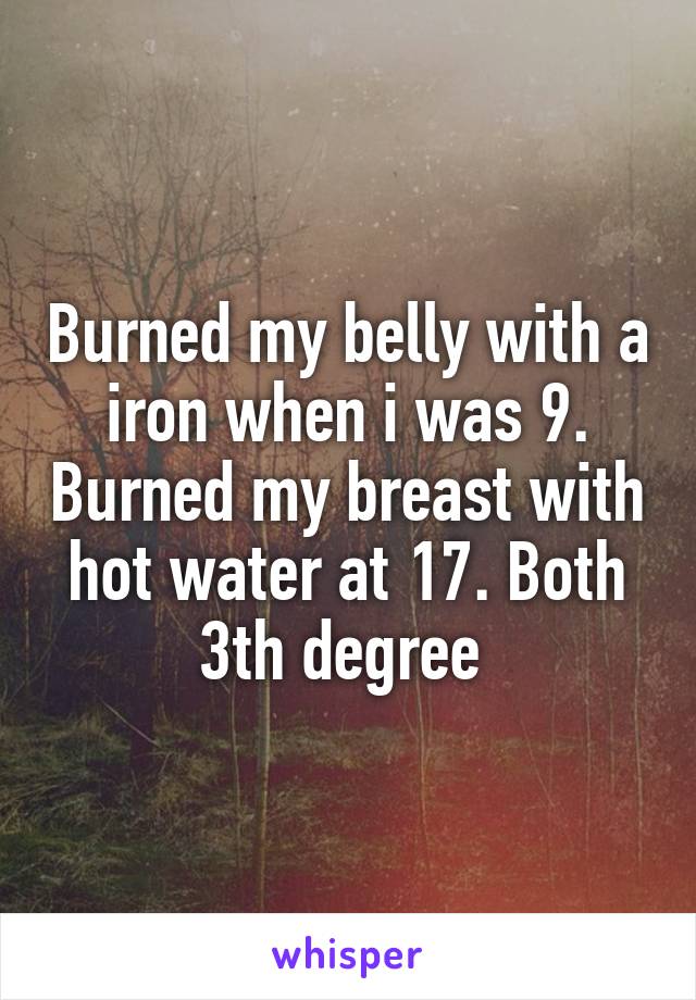 Burned my belly with a iron when i was 9. Burned my breast with hot water at 17. Both 3th degree 