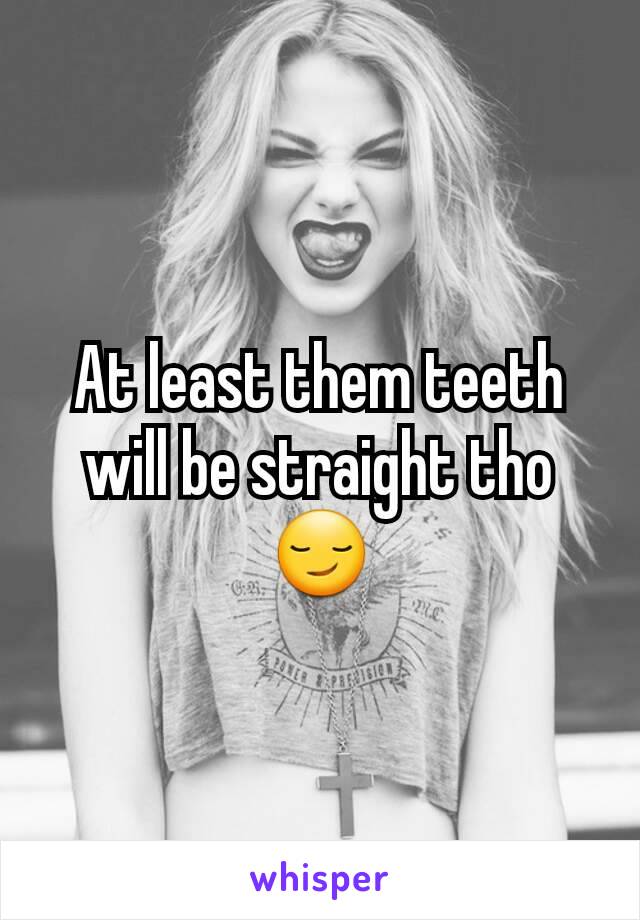 At least them teeth will be straight tho 😏