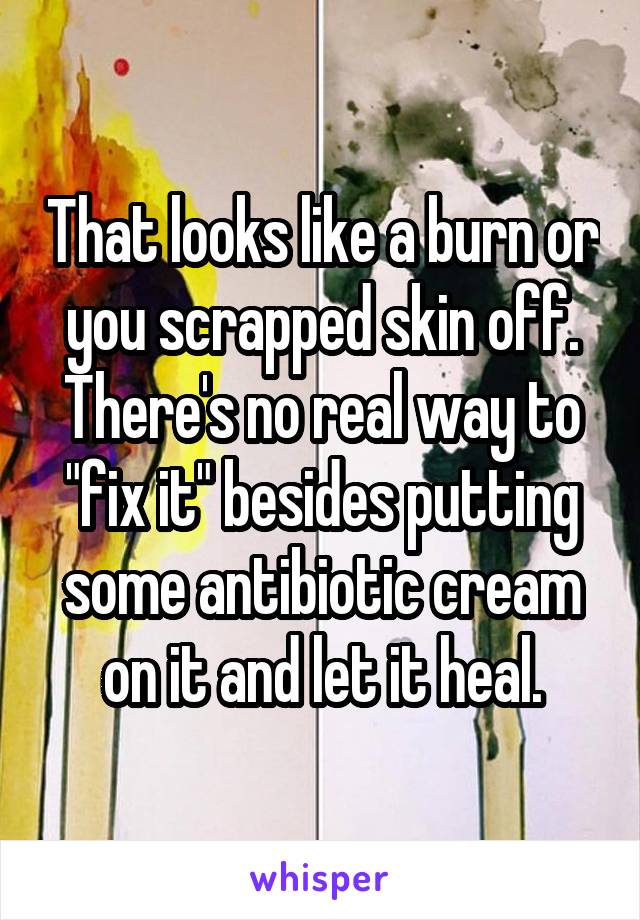 That looks like a burn or you scrapped skin off. There's no real way to "fix it" besides putting some antibiotic cream on it and let it heal.