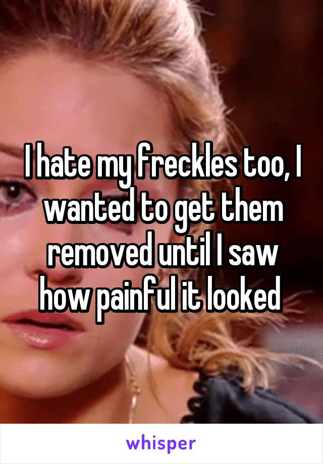 I hate my freckles too, I wanted to get them removed until I saw how painful it looked 