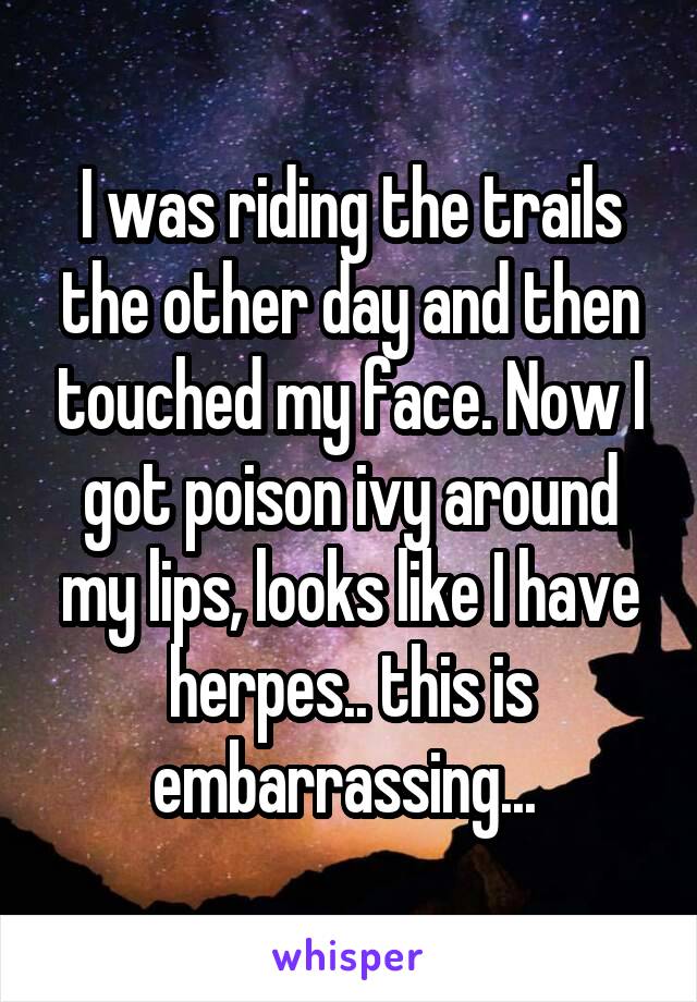 I was riding the trails the other day and then touched my face. Now I got poison ivy around my lips, looks like I have herpes.. this is embarrassing... 