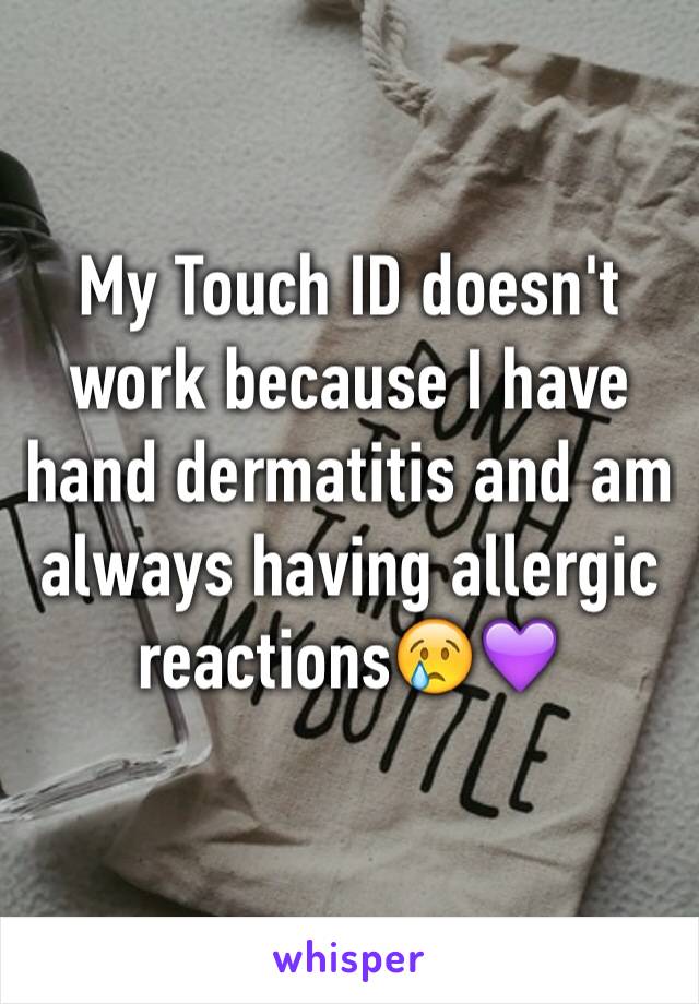 My Touch ID doesn't work because I have hand dermatitis and am always having allergic reactions😢💜