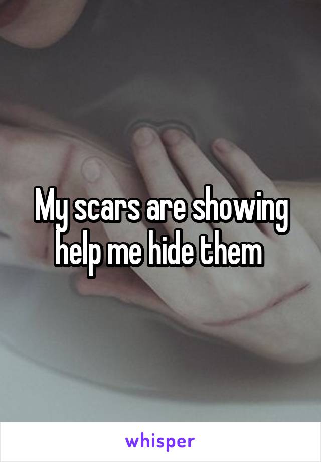 My scars are showing help me hide them 