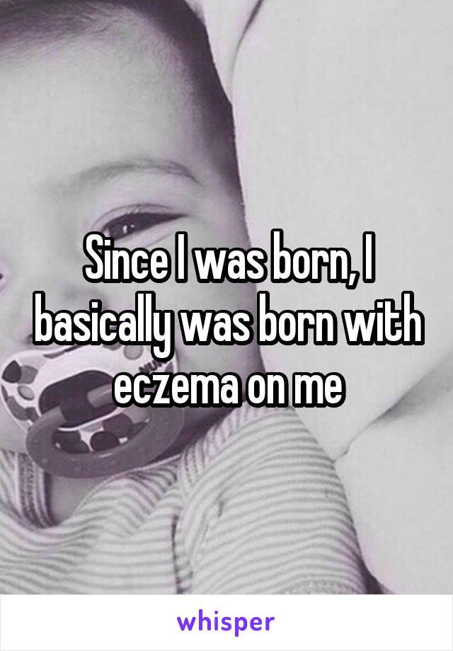 Since I was born, I basically was born with eczema on me