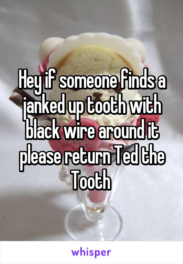 Hey if someone finds a janked up tooth with black wire around it please return Ted the Tooth 