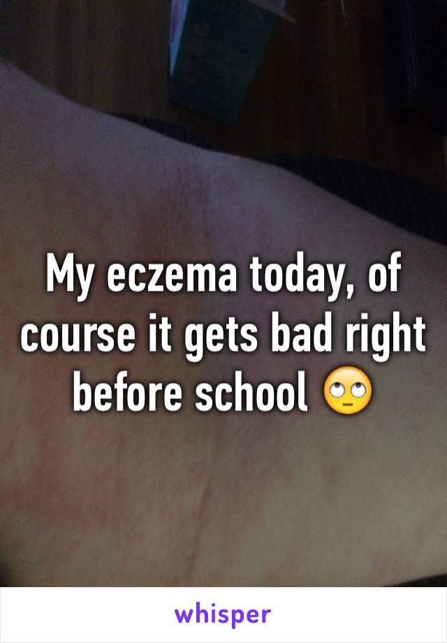 My eczema today, of course it gets bad right before school 🙄