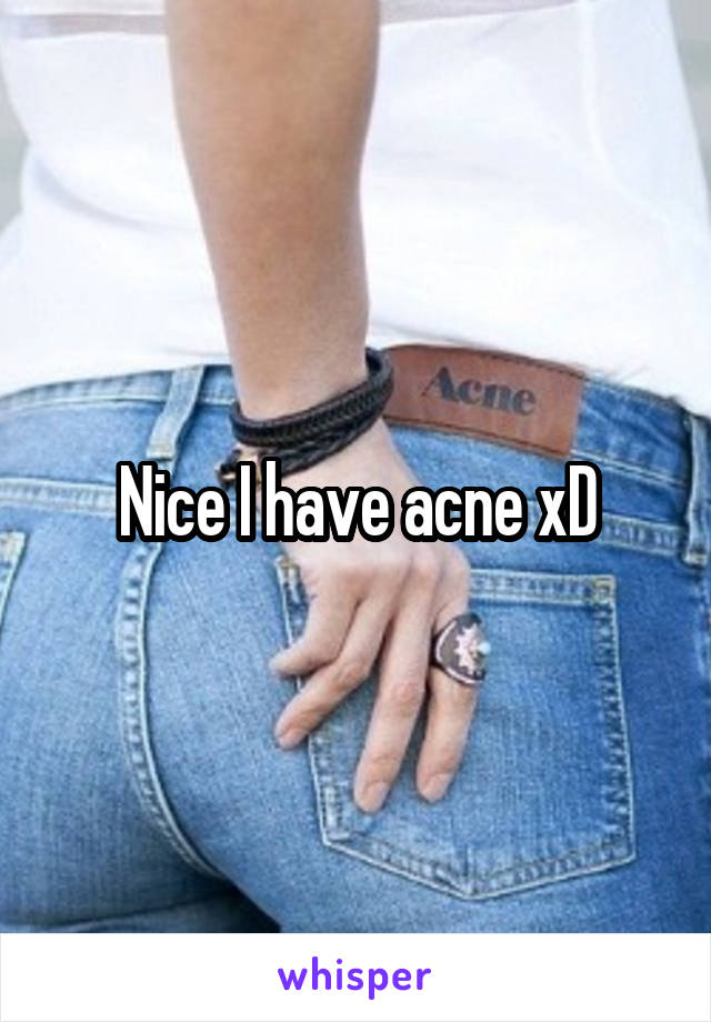 Nice I have acne xD