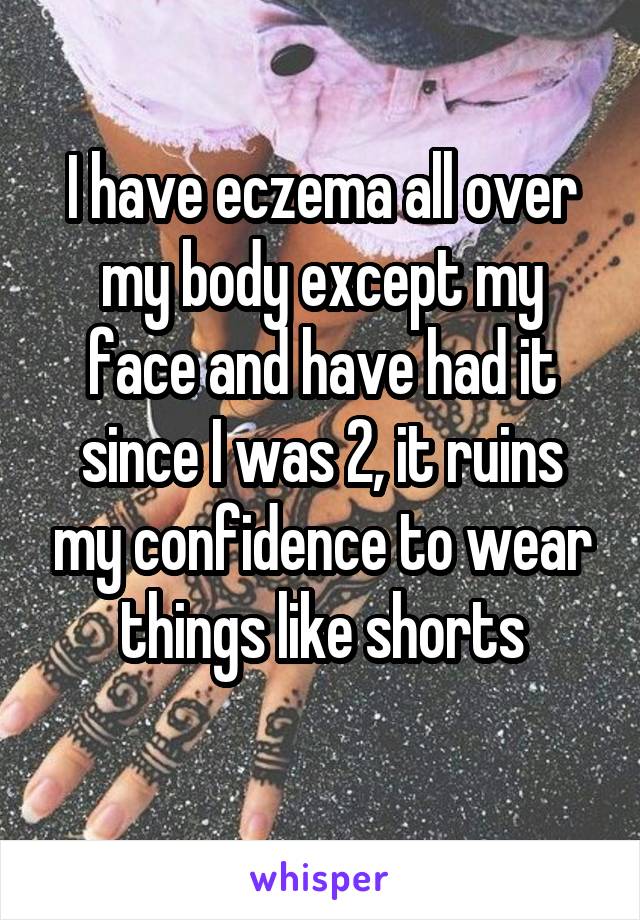 I have eczema all over my body except my face and have had it since I was 2, it ruins my confidence to wear things like shorts
