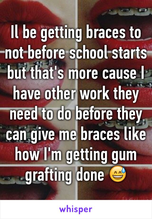 Il be getting braces to not before school starts but that's more cause I have other work they need to do before they can give me braces like how I'm getting gum grafting done 😅