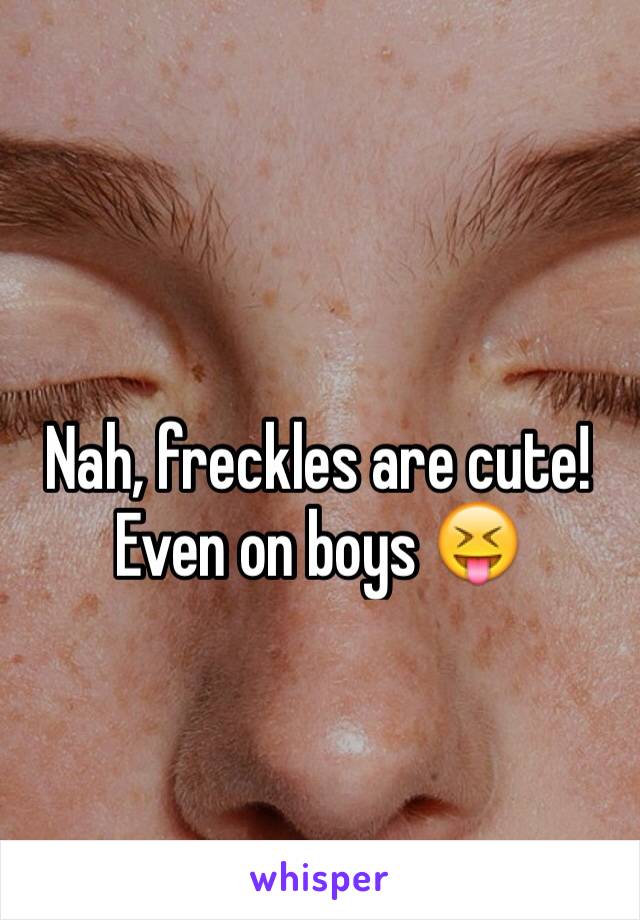 Nah, freckles are cute! Even on boys 😝