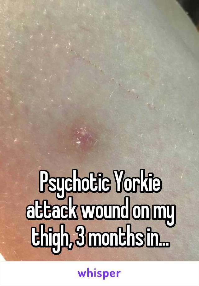 




Psychotic Yorkie attack wound on my thigh, 3 months in...