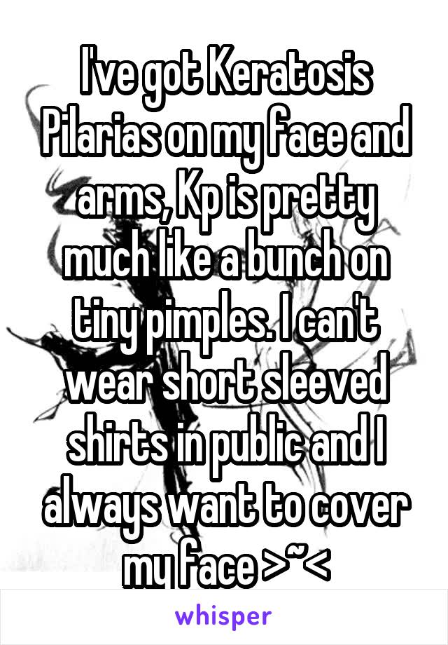 I've got Keratosis Pilarias on my face and arms, Kp is pretty much like a bunch on tiny pimples. I can't wear short sleeved shirts in public and I always want to cover my face >~<