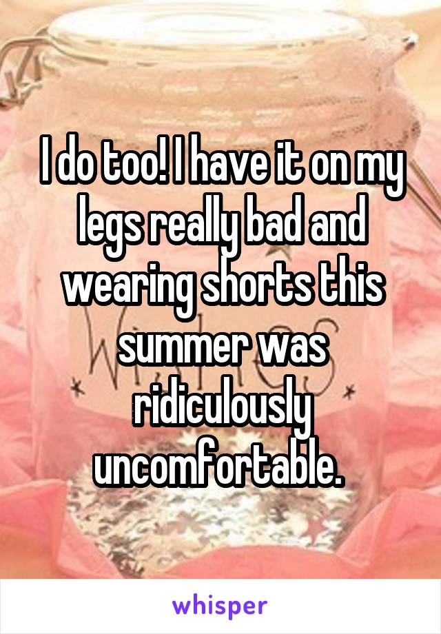 I do too! I have it on my legs really bad and wearing shorts this summer was ridiculously uncomfortable. 