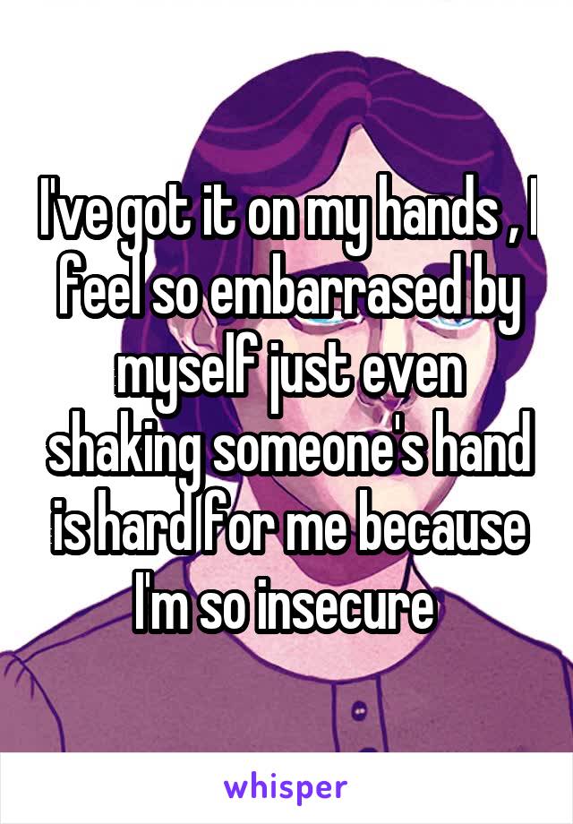 I've got it on my hands , I feel so embarrased by myself just even shaking someone's hand is hard for me because I'm so insecure 