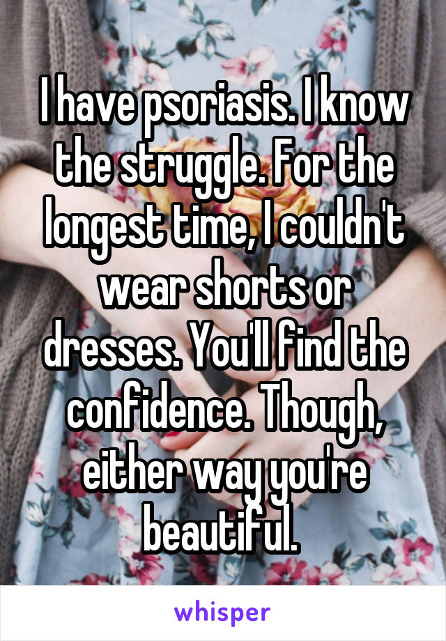 I have psoriasis. I know the struggle. For the longest time, I couldn't wear shorts or dresses. You'll find the confidence. Though, either way you're beautiful. 