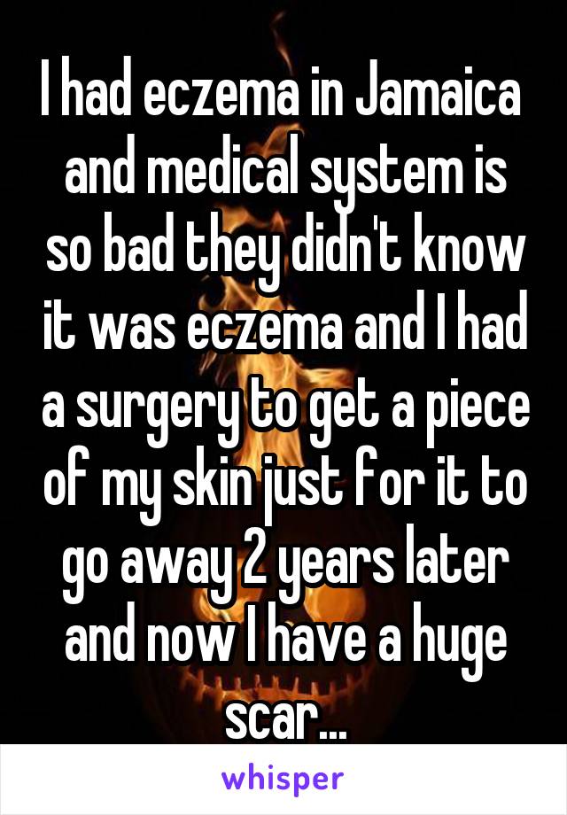 I had eczema in Jamaica  and medical system is so bad they didn't know it was eczema and I had a surgery to get a piece of my skin just for it to go away 2 years later and now I have a huge scar...