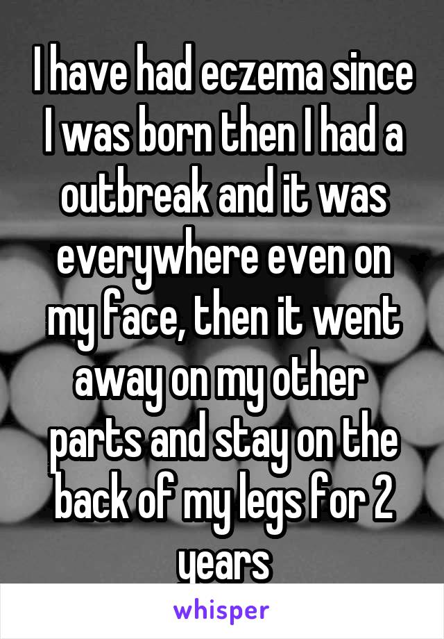 I have had eczema since I was born then I had a outbreak and it was everywhere even on my face, then it went away on my other  parts and stay on the back of my legs for 2 years