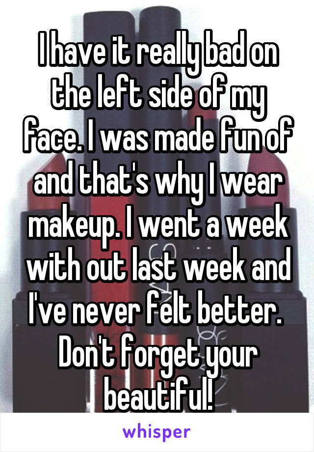 I have it really bad on the left side of my face. I was made fun of and that's why I wear makeup. I went a week with out last week and I've never felt better. 
Don't forget your beautiful!