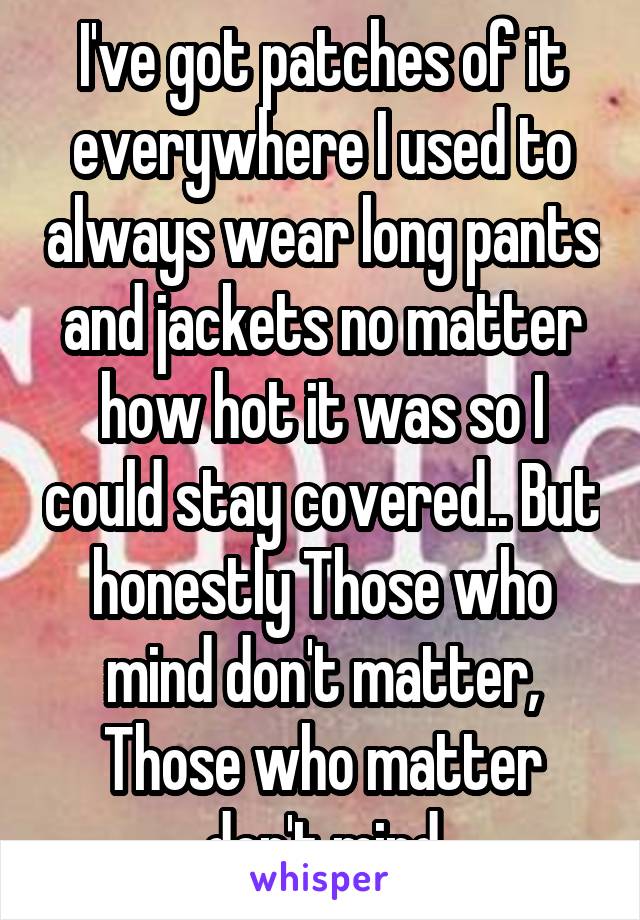 I've got patches of it everywhere I used to always wear long pants and jackets no matter how hot it was so I could stay covered.. But honestly Those who mind don't matter, Those who matter don't mind