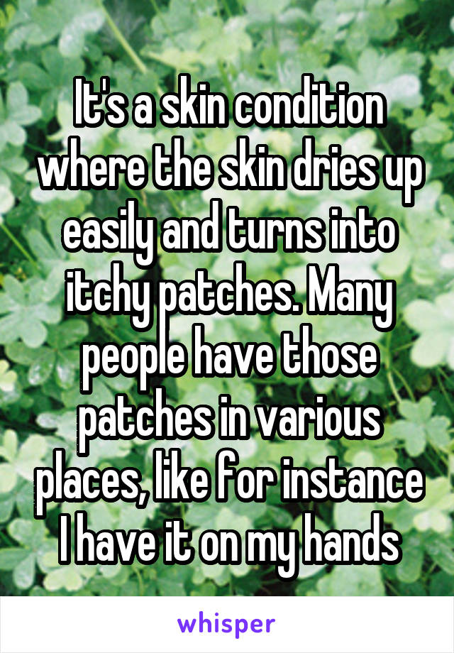 It's a skin condition where the skin dries up easily and turns into itchy patches. Many people have those patches in various places, like for instance I have it on my hands