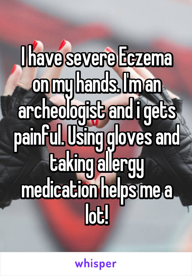 I have severe Eczema on my hands. I'm an archeologist and i gets painful. Using gloves and taking allergy medication helps me a lot!