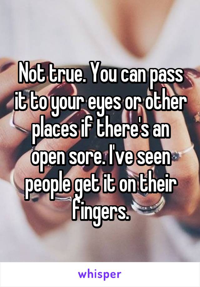 Not true. You can pass it to your eyes or other places if there's an open sore. I've seen people get it on their fingers.