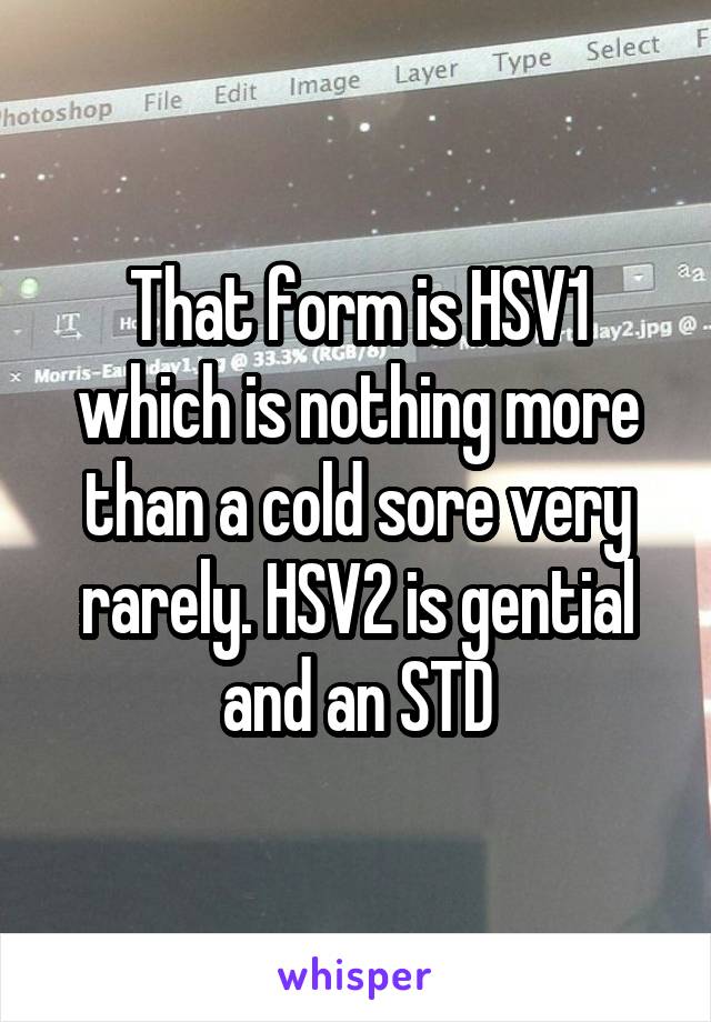 That form is HSV1 which is nothing more than a cold sore very rarely. HSV2 is gential and an STD