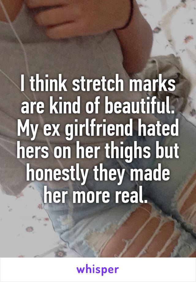 I think stretch marks are kind of beautiful. My ex girlfriend hated hers on her thighs but honestly they made her more real. 